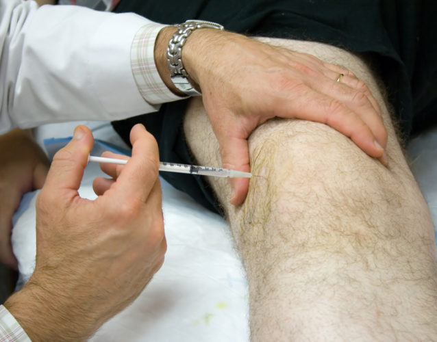 Meniscus Tear Alternative to Surgery with Stem Cells and PRP